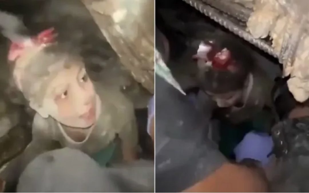 لماذا رفضت الطفلة “ألما” انتشالها من تحت ركام منزلها بغزة (شاهد)