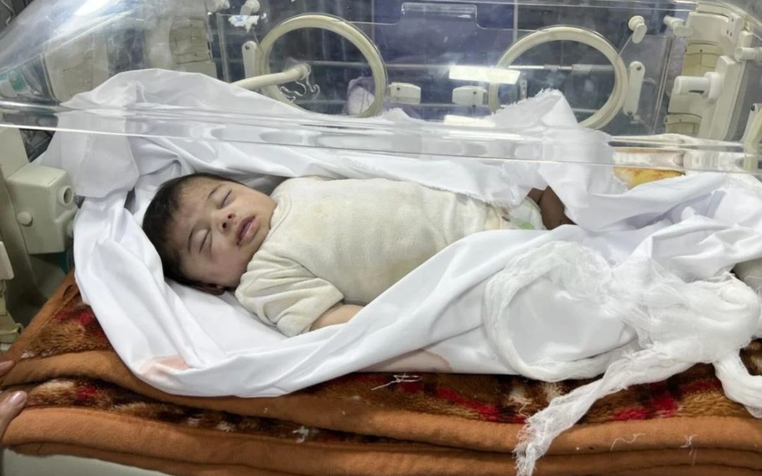 نتيجة لسوء التغذية.. 7 أطفال ينضمون إلى ضحايا المجاعة في شمال غزة