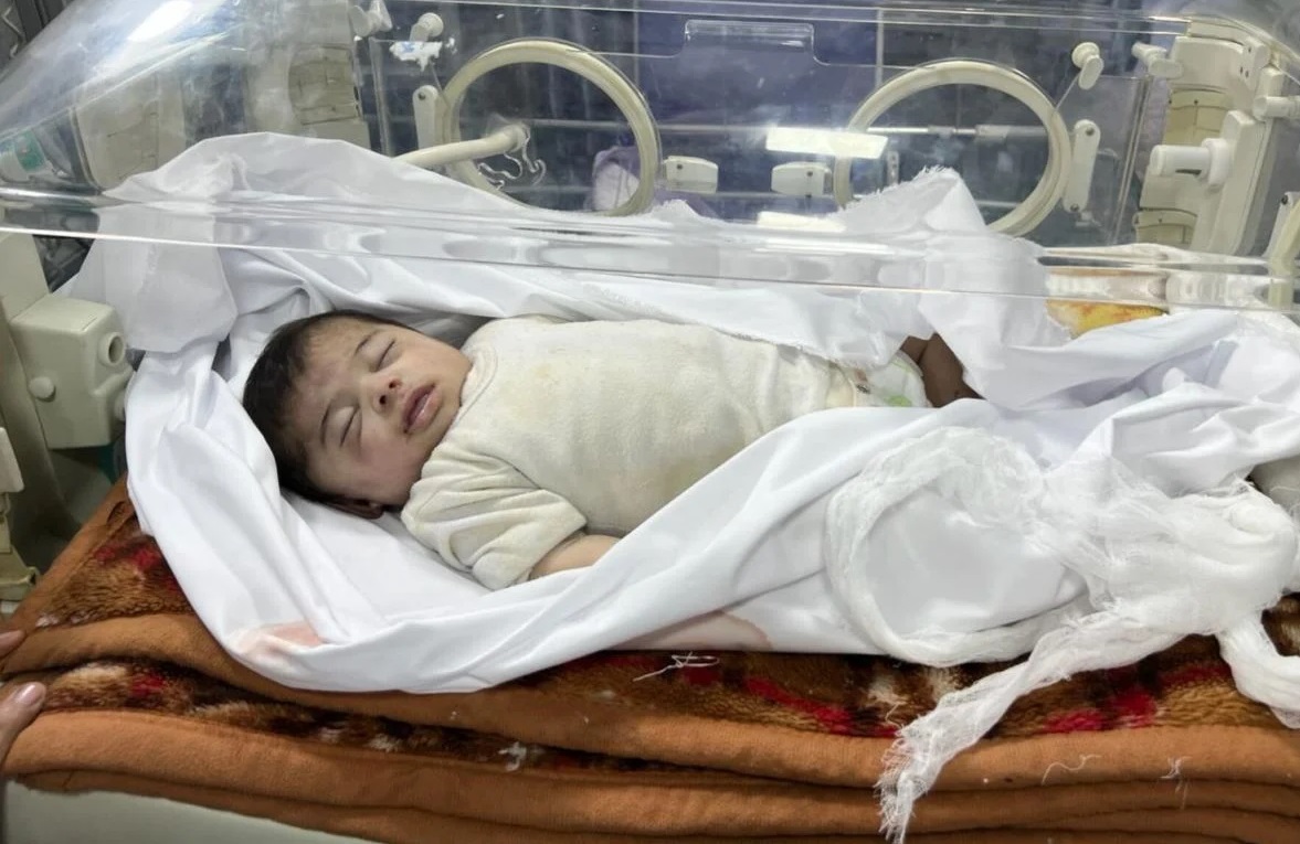 وفاة أطفال في مستسفى كمال عدوان