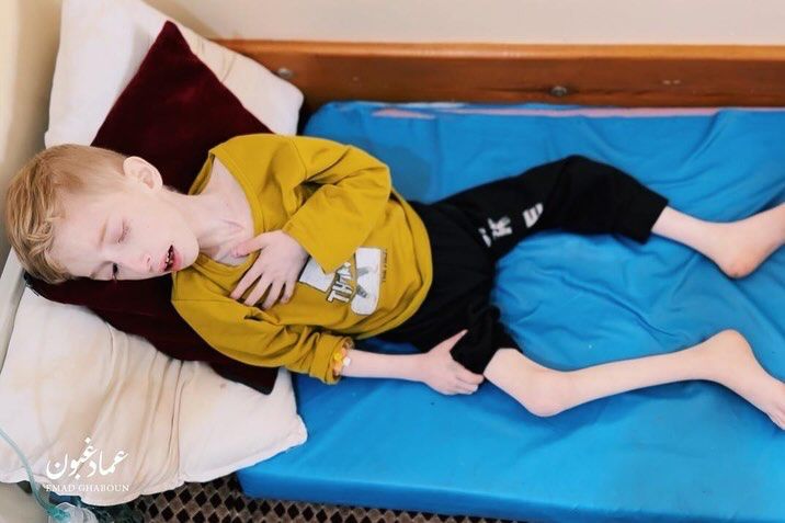 فادي الزنط .. طفل فلسطيني مريض يواجه خطر الموت جوعًا شمال غزة