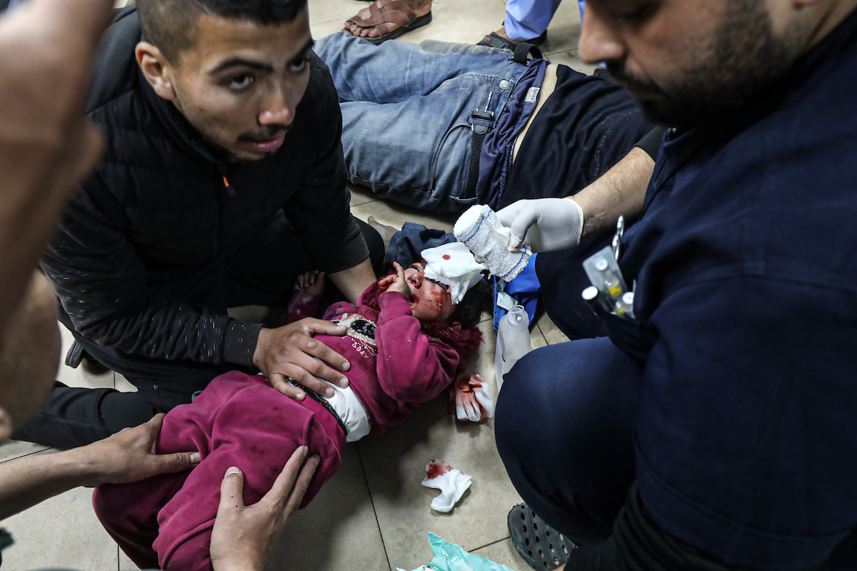 إصابات أطفال غزة