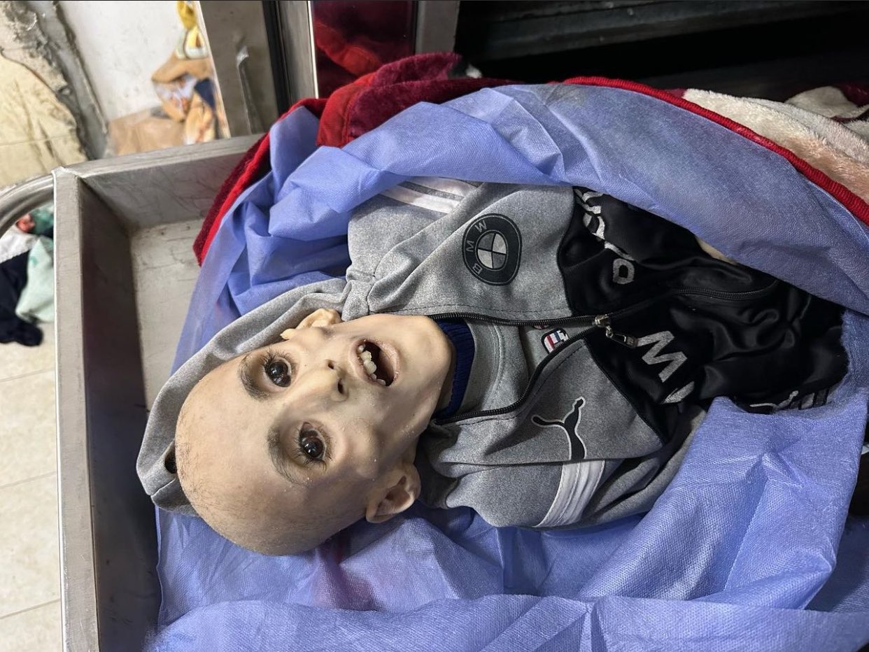 الطفل الكفارنة.. يرحل “هيكلاً عظميًا” شاهدًا على “حرب التجويع والإبادة” في غزة