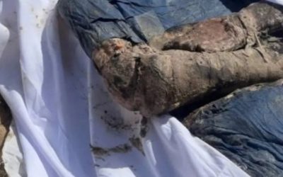 تقرير أممي: دفن أكثر من 20 فلسطينا أحياء في مجمع ناصر الطبي