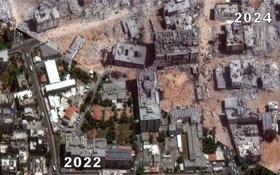 صور صادمة.. مستشفيات غزة قبل عدوان الاحتلال وبعده