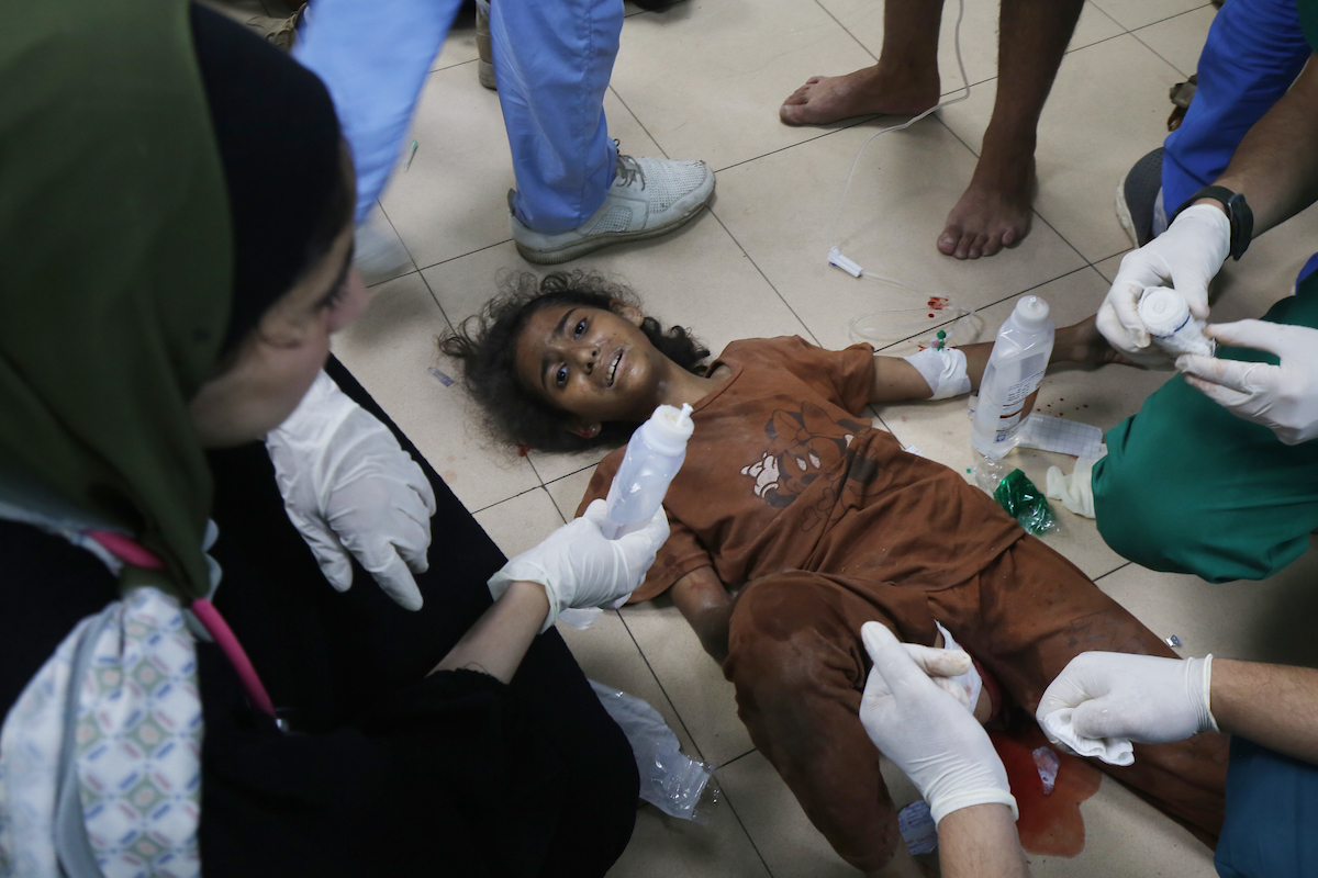 أطفال غزة المصابين