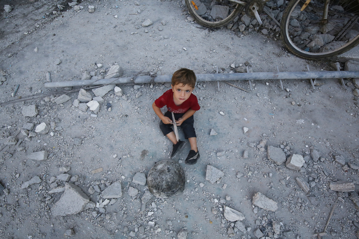 50 طفلا يعانون من سوء التغذية والمجاعة شمال غزة