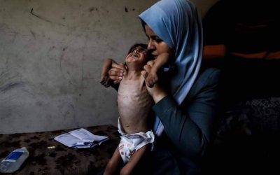 الحصيلة ترتفع إلى 40 .. استشهاد طفل بسبب المجاعة في قطاع غزة