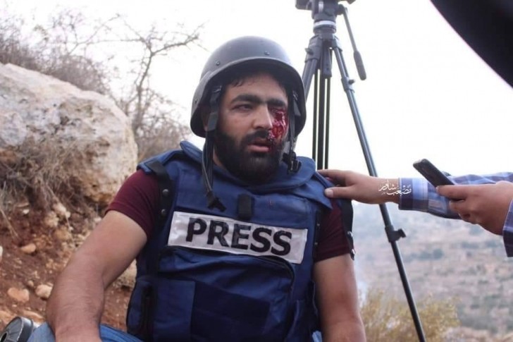  الصحفي الجريح معاذ عمارنة يتنسّم الحريّة بعد 9 أشهر من الاعتقال