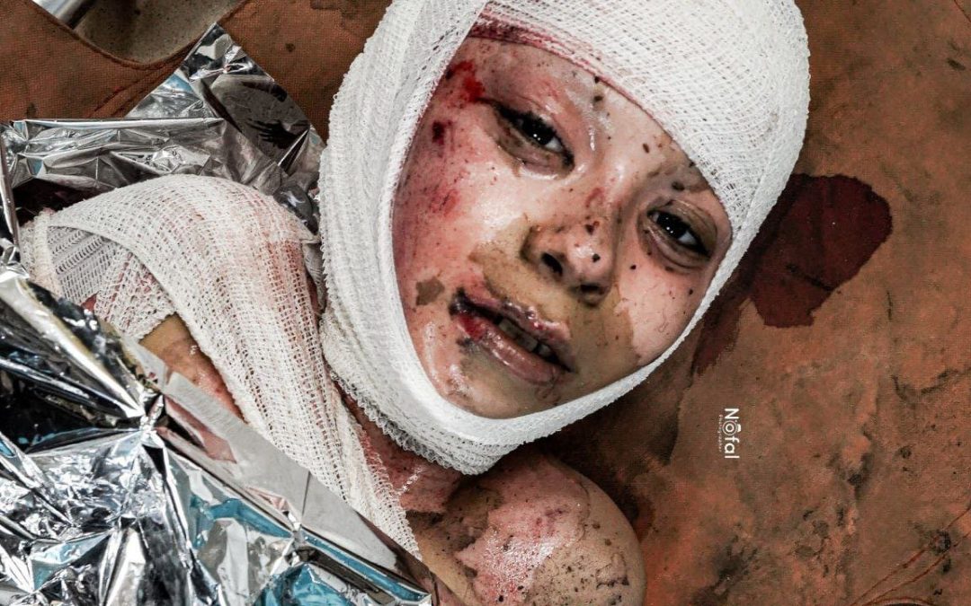الإعلام الحكومي: 320 شهيدًا ومصابًا وصلوا لمستشفيات غزة بأجسادٍ محروقةٍ