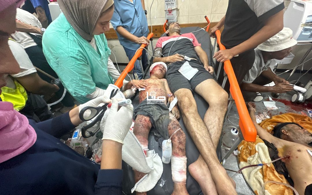 31 شهيداً و 100 جريح بمجزرة للاحتلال بمشفى ميداني في دير البلح