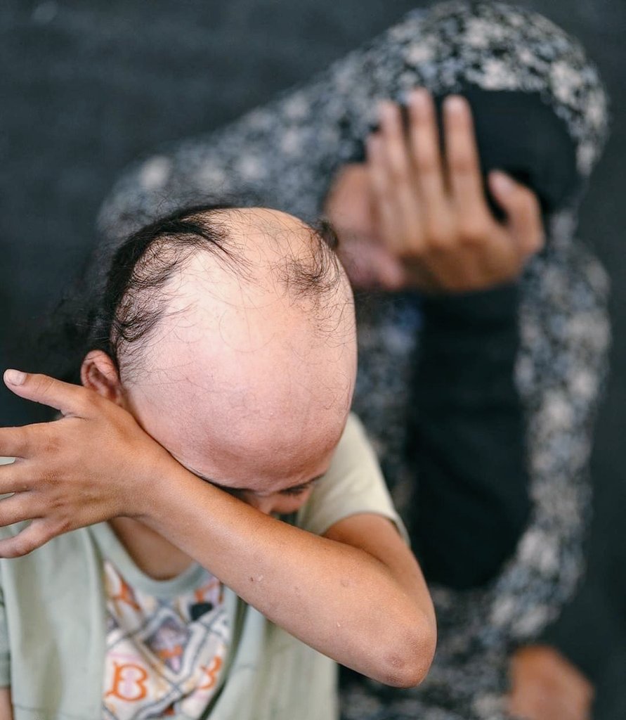 سما بدون شعر.. طفلة جميلة ترى بعينيها آلام غزة وأوجاعها سما بدون شعر.. طفلة جميلة ترى بعينيها آلام غزة وأوجاعها