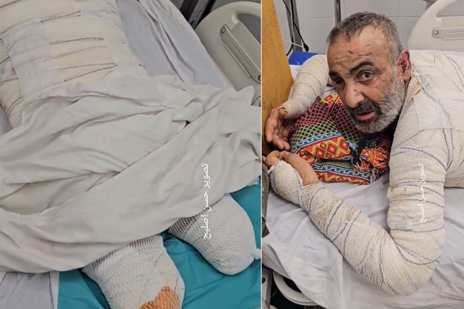رجاء أبو عويضة.. الجريح ووالد الشهداء وآلام لا توصف رجاء أبو عويضة.. الجريح ووالد الشهداء وآلام لا توصف