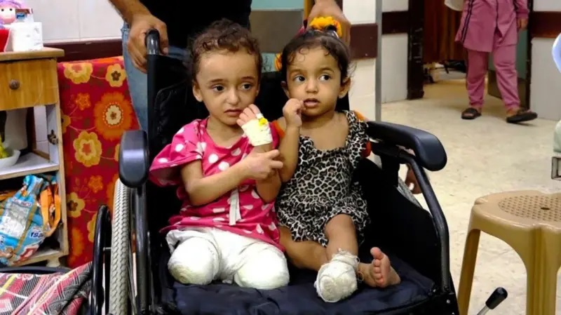 مبتورو الأطراف في غزة يكافحون من أجل استعادة حياة
