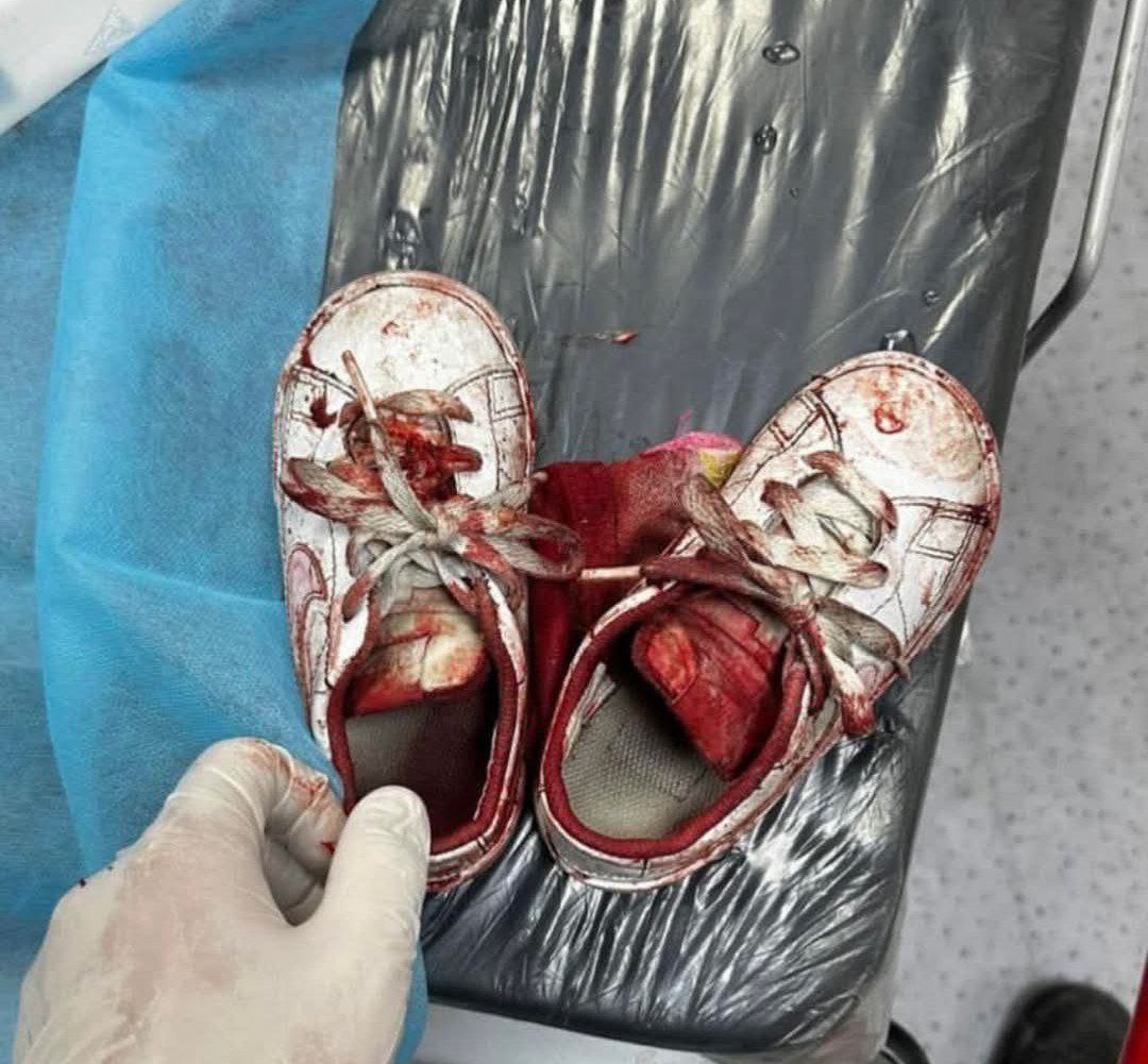 الصحة: 42 شهيداً و183 جريحاً في غزة خلال 24 ساعة الصحة: 42 شهيداً و183 جريحاً في غزة خلال 24 ساعة