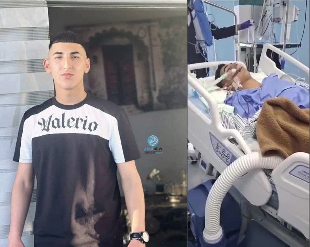 استشهاد شاب في مخيم الجلزون متأثرًا بإصابته استشهاد شاب في مخيم الجلزون متأثرًا بإصابته