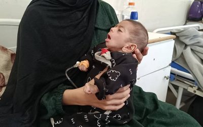 استشهاد رضيعة في غزة بسبب سوء التغذية