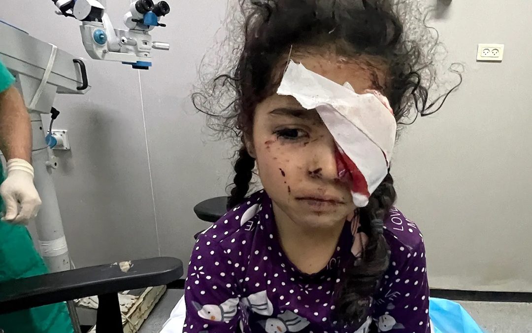 1500 مواطن فقدوا بصرهم جراء الإبادة في غزة