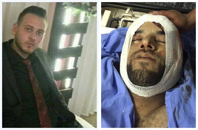 شهيدان وعشرات الإصابات في اقتحام الاحتلال مخيم قلنديا (صور)