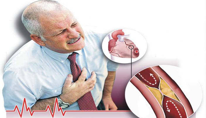 تقنية تتنبأ بالنوبة القلبية قبل حدوثها بسنوات