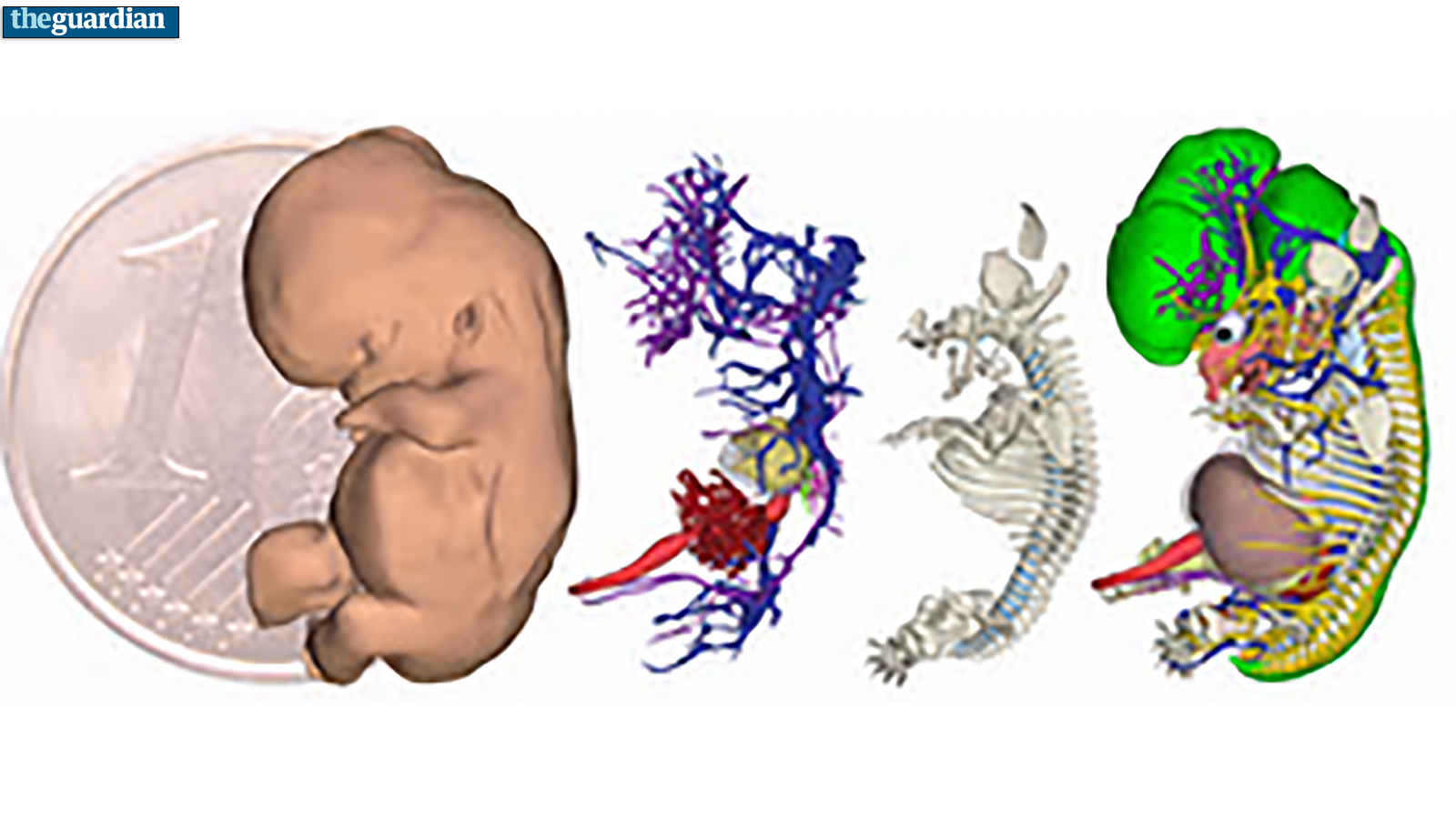 أول أطلس ثلاثي الأبعاد يكشف مراحل تطور الجنين