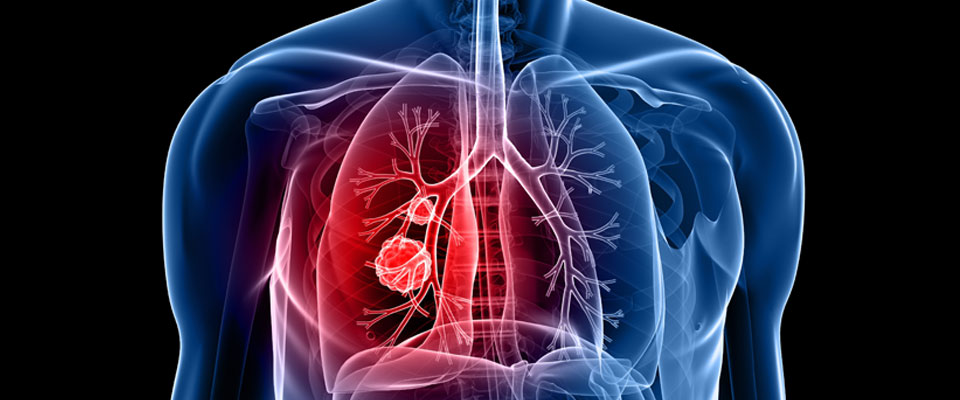تلوث الهواء قد يؤدي لتلف الرئتين وفشل القلب