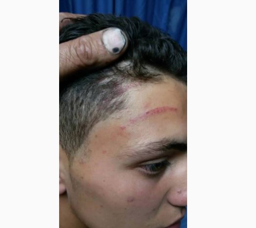 وقائي الخليل يعتدي بالضرب المبرح على فتى أثناء اعتقاله