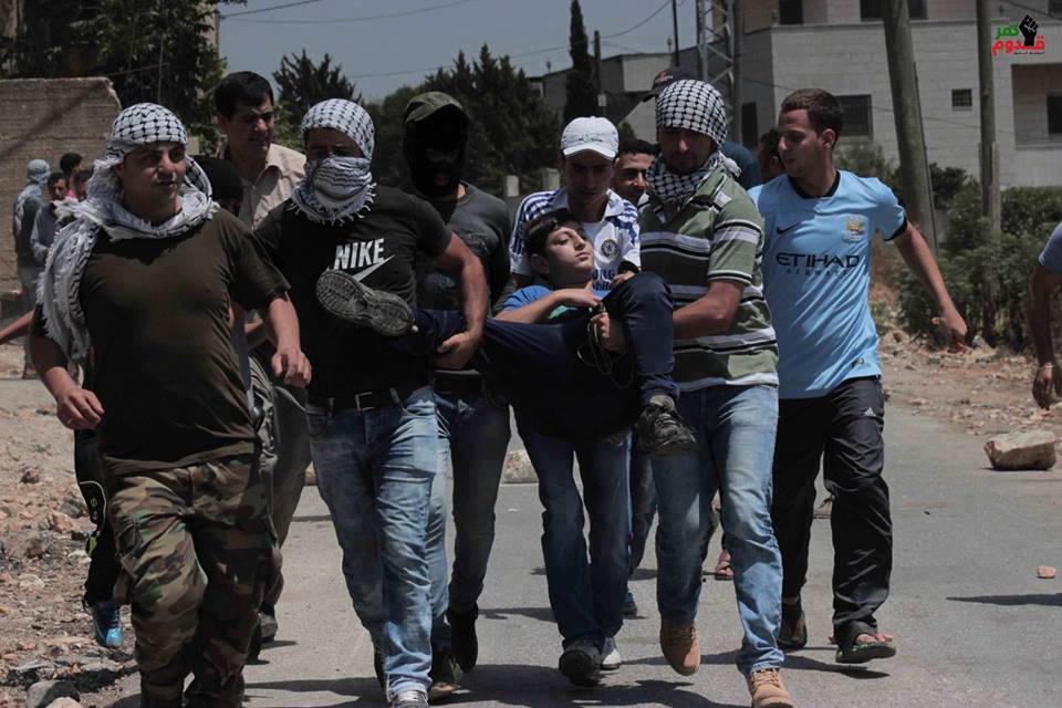 استشهاد مواطنيْن وإصابة 44 بنيران الاحتلال الأسبوع الماضي