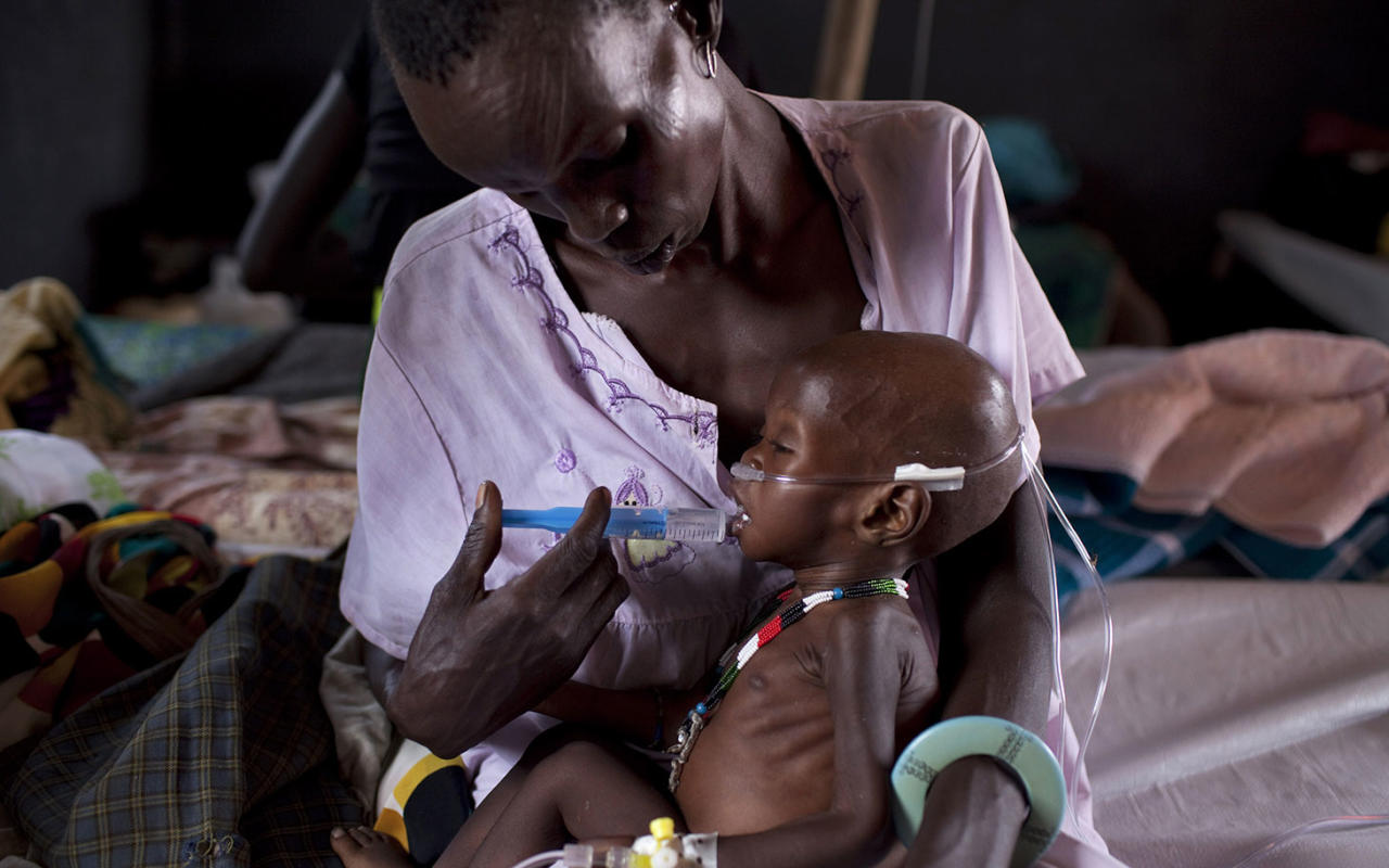 يونيسف: 1.4 مليون طفل مهددون بالموت جوعاً