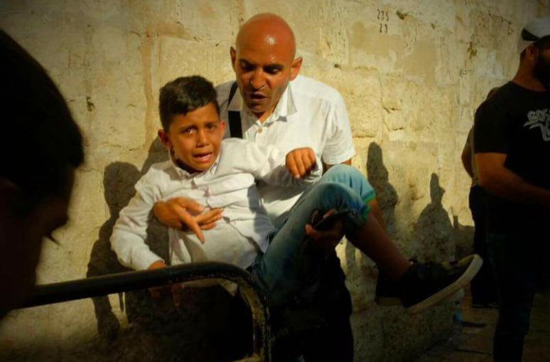 إصابات باعتداء الاحتلال على المصلين في القدس