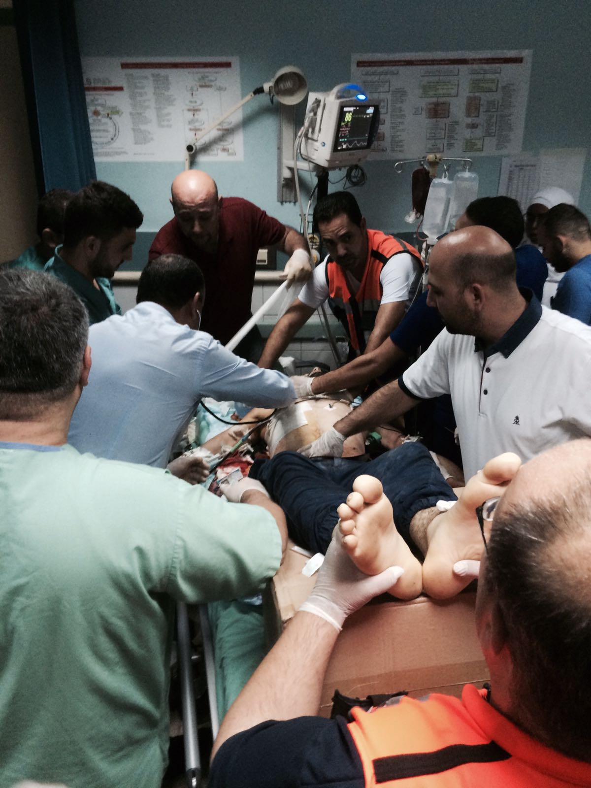 إصابة شاب بجروح خطيرة في رأسه خلال مواجهات القدس