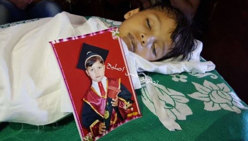 الطفل السايس.. أزمات غزة دحرجته بينها حتى الموت