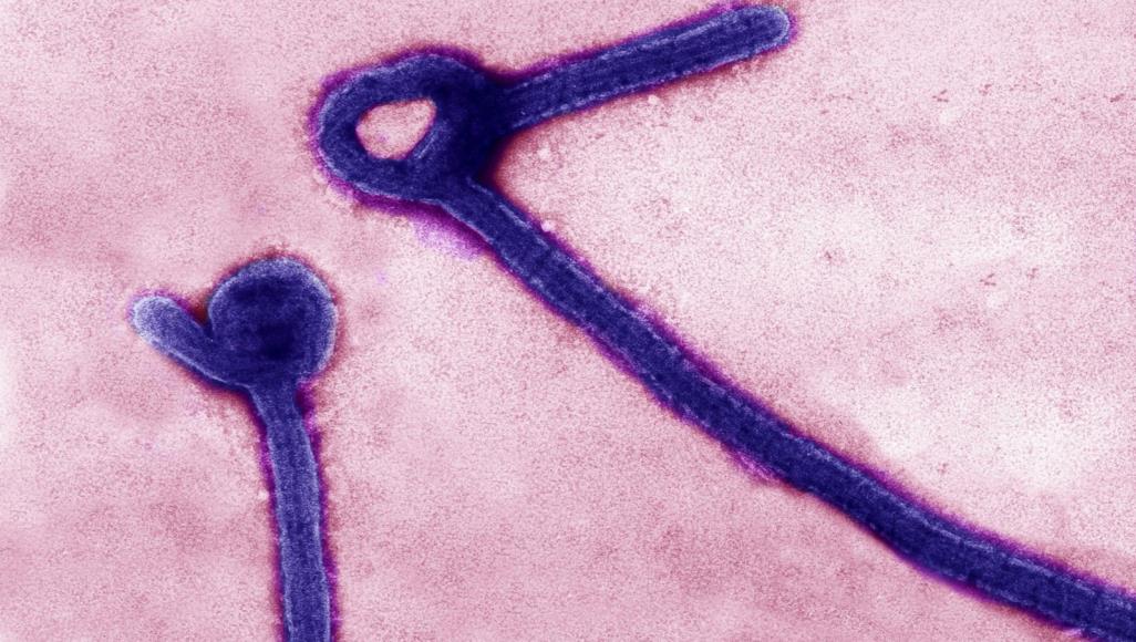 ماذا تعرف عن فيروس ماربورغ المرعب؟