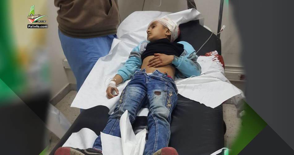 إصابة طفلة فلسطينية بمخيم البداوي برصاصة منفلتة