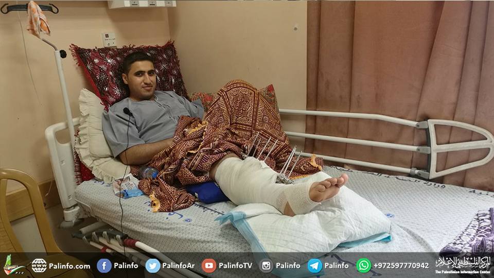 وفد طبي تركي يزور غزة لإجراء عمليات جراحية