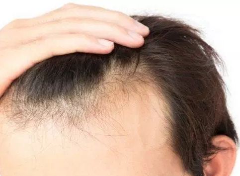4 نصائح لزيادة نمو الشعر