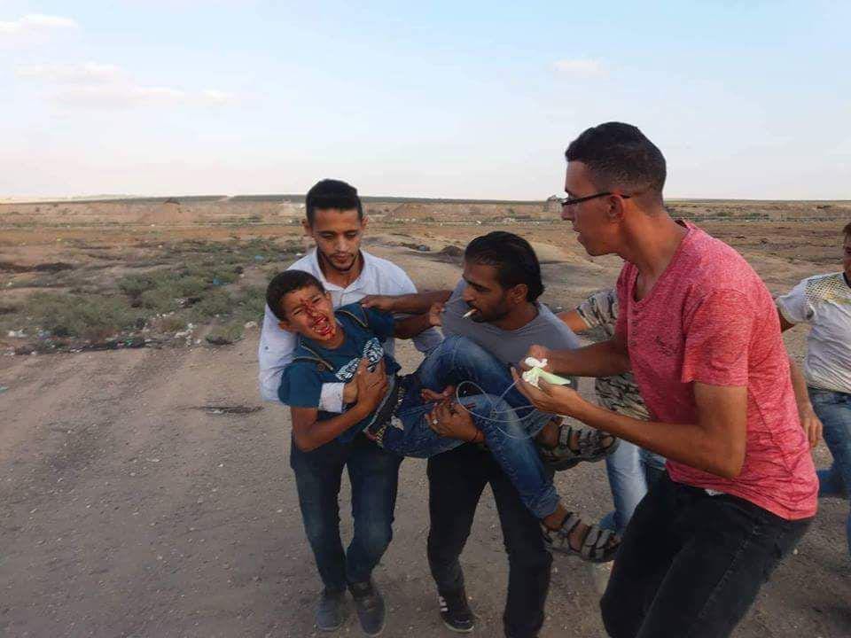 إصابة برصاص الاحتلال شرق غزة