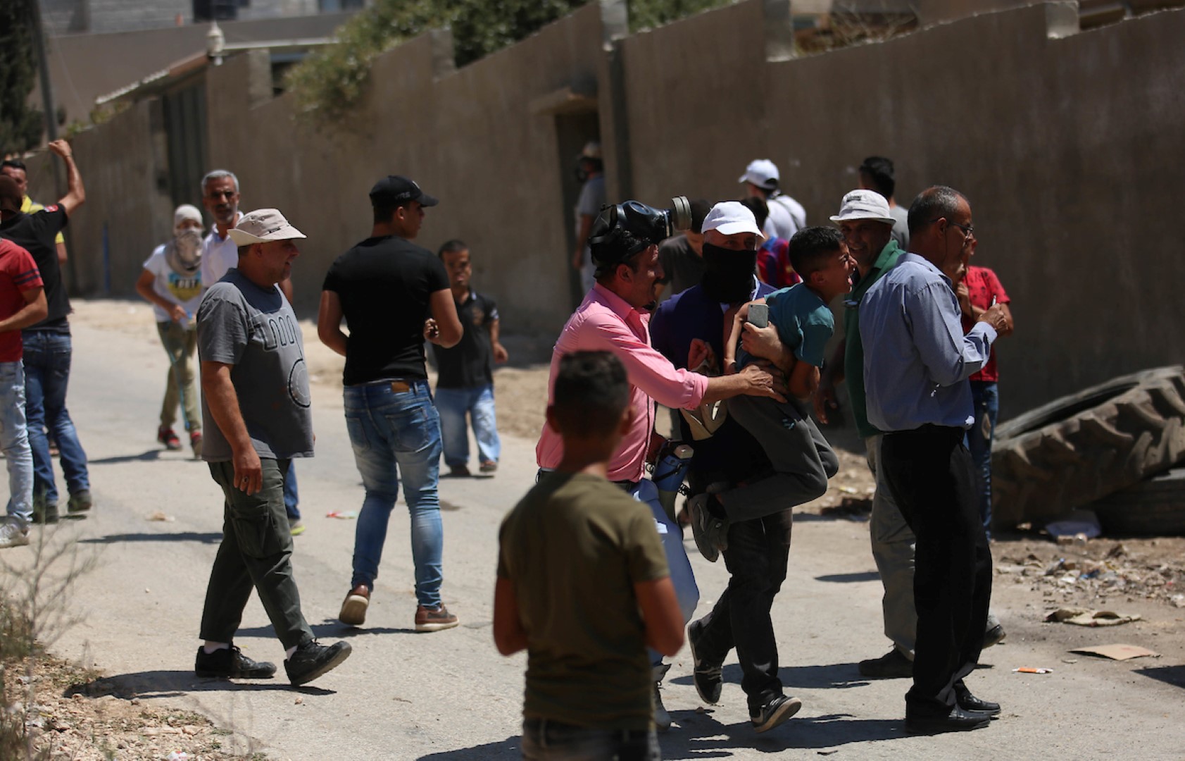 الاحتلال يُصيب شابًّا بالرصاص الحي شرق قلقيلية