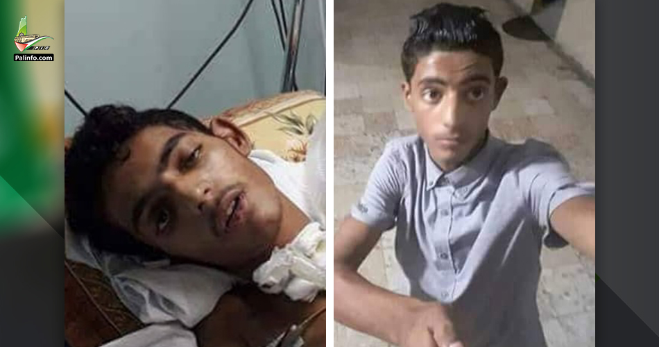 استشهاد طفل متأثرًا بإصابته برصاص الاحتلال شرق خانيونس
