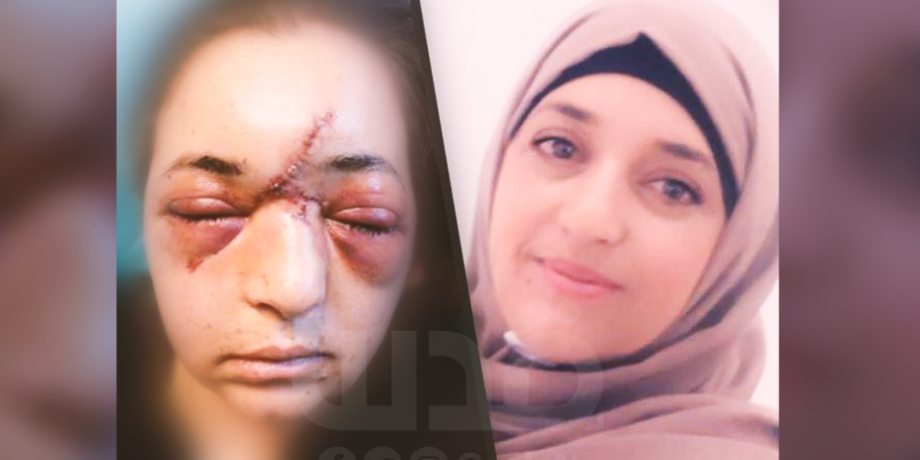 الاحتلال يحول حياة فلسطينية دافعت عن طفلها إلى جحيم