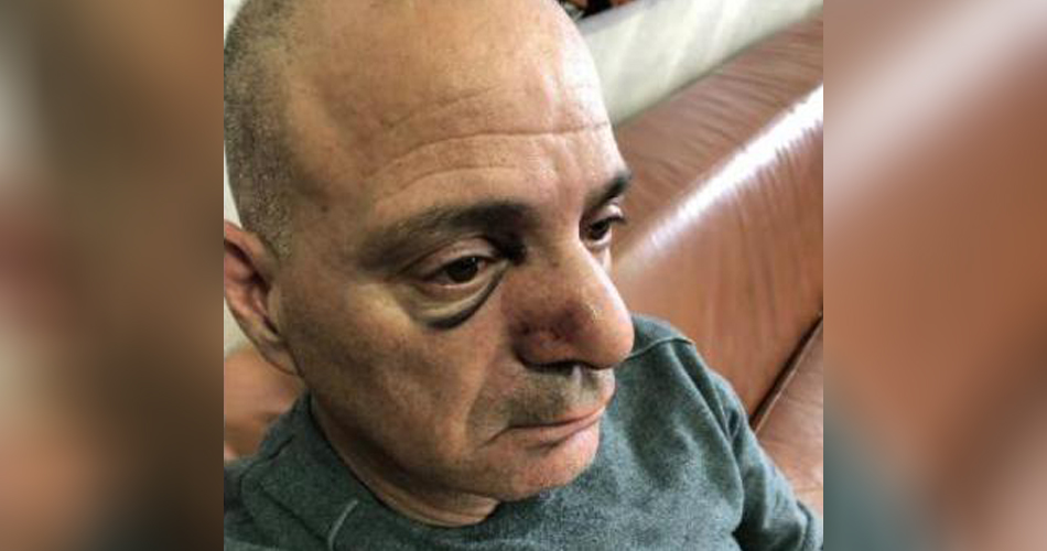 مستوطنون يعتدون على مواطن مقدسي