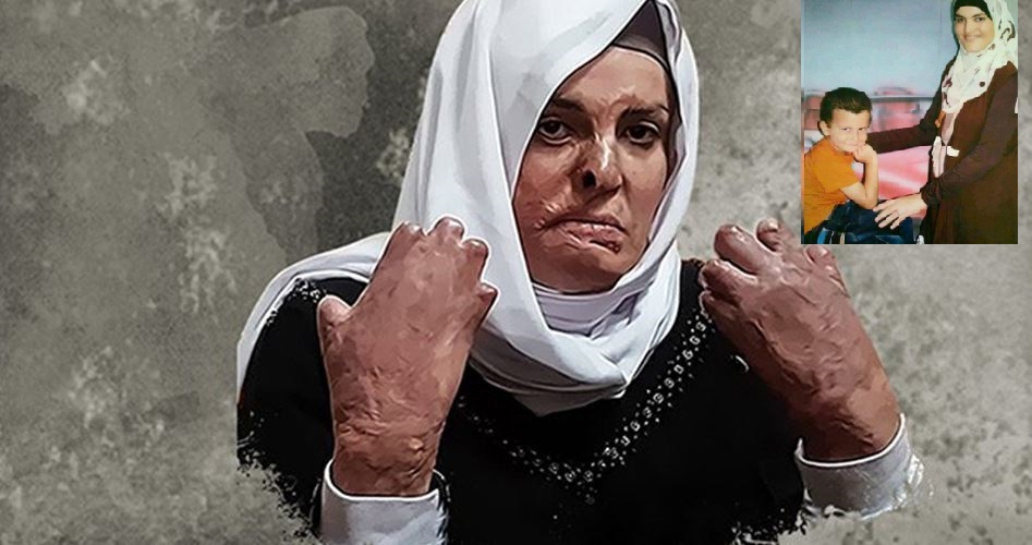 الأسيرة إسراء جعابيص تدخل عامها السادس في سجون إسرائيل