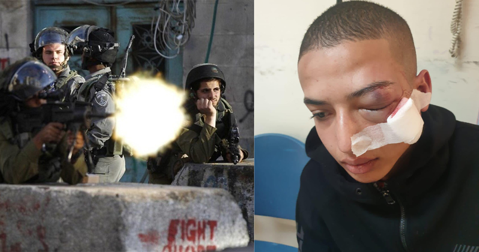 إصابة فتىً في عينه برصاص الاحتلال بالقدس