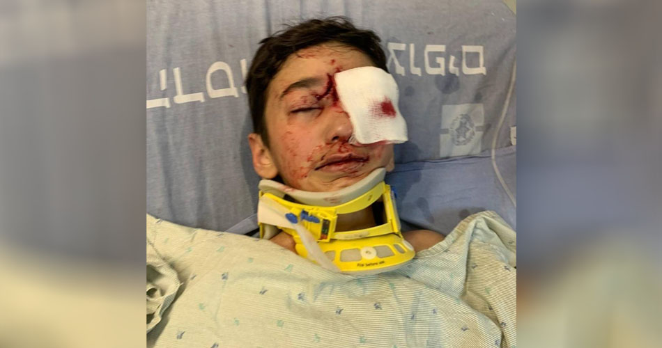 أطباء يقررون استئصال عين طفل فلسطيني أصيب برصاصة إسرائيلية