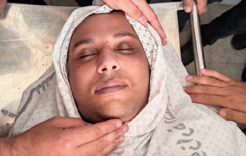 شهيد متأثرًا بجراحه في العدوان على غزة