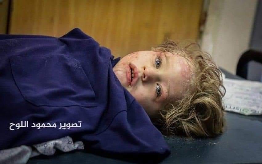 الطفل أحمد اليازجي.. ذاق مرارة اليُتم مرّتين