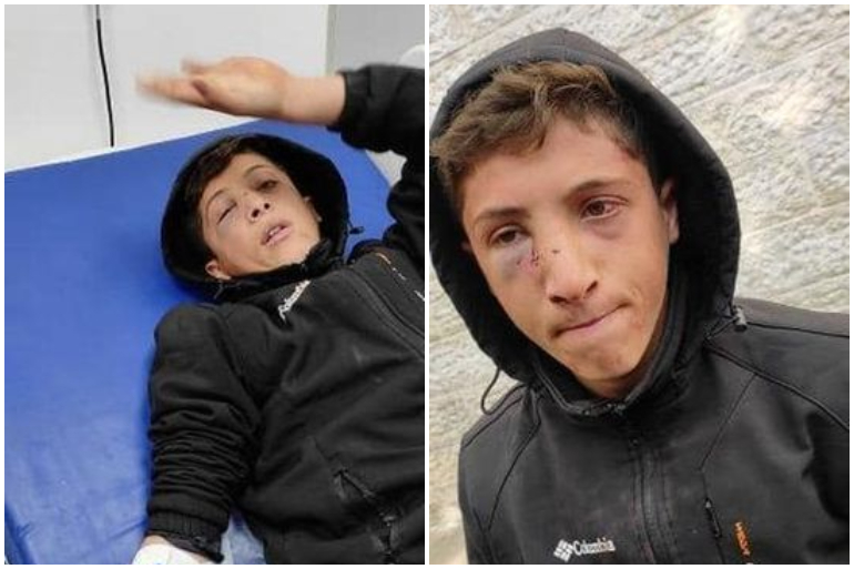 الاحتلال يعتدي على طفل من رام الله