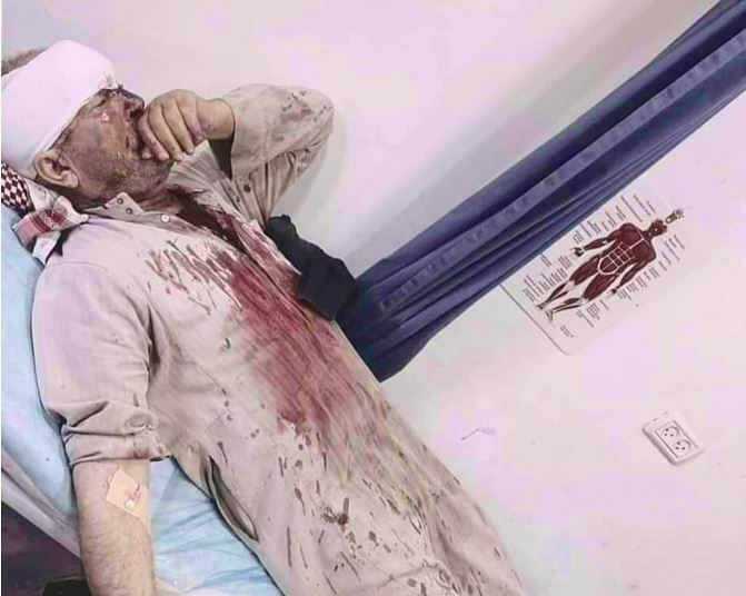 إصابة مسنّ تعرض لاعتداء من مستوطنين في بيت لحم