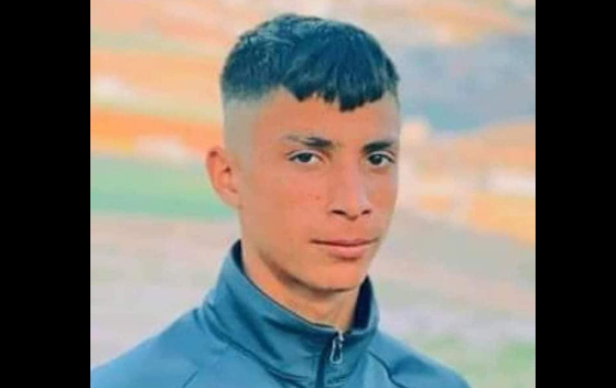 استشهاد فتى متأثرًا بجراحه برصاص الاحتلال في نابلس