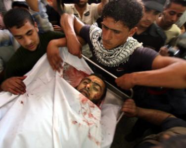 صعوبات في نقل مصابي غزة بسبب بسبب نفاد الوقود