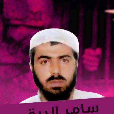 نقل الأسير سامر البرق للعناية المكثفة لتدهور صحته